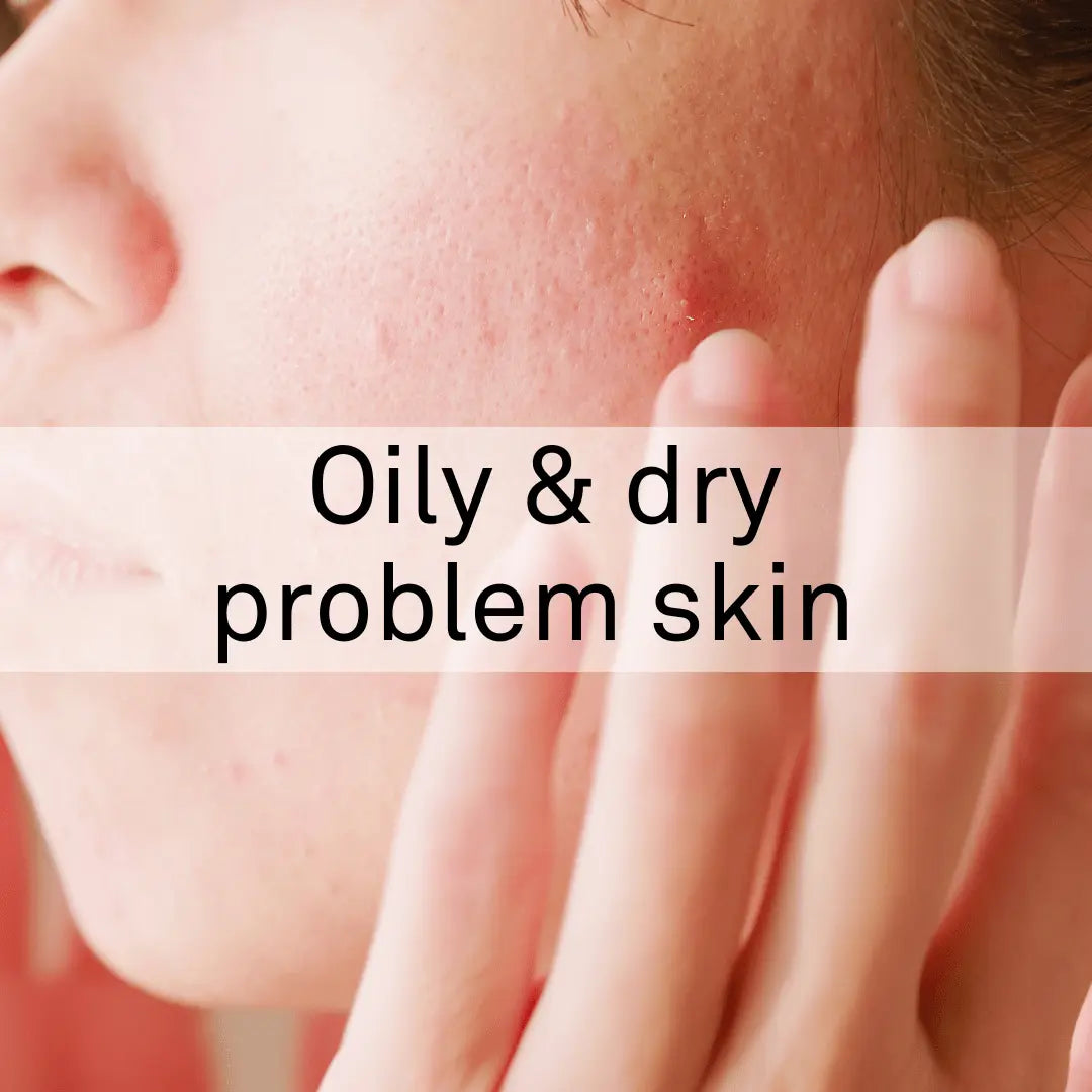 For Combination Skin with Blackheads | Treatment – Bravuralondon.com