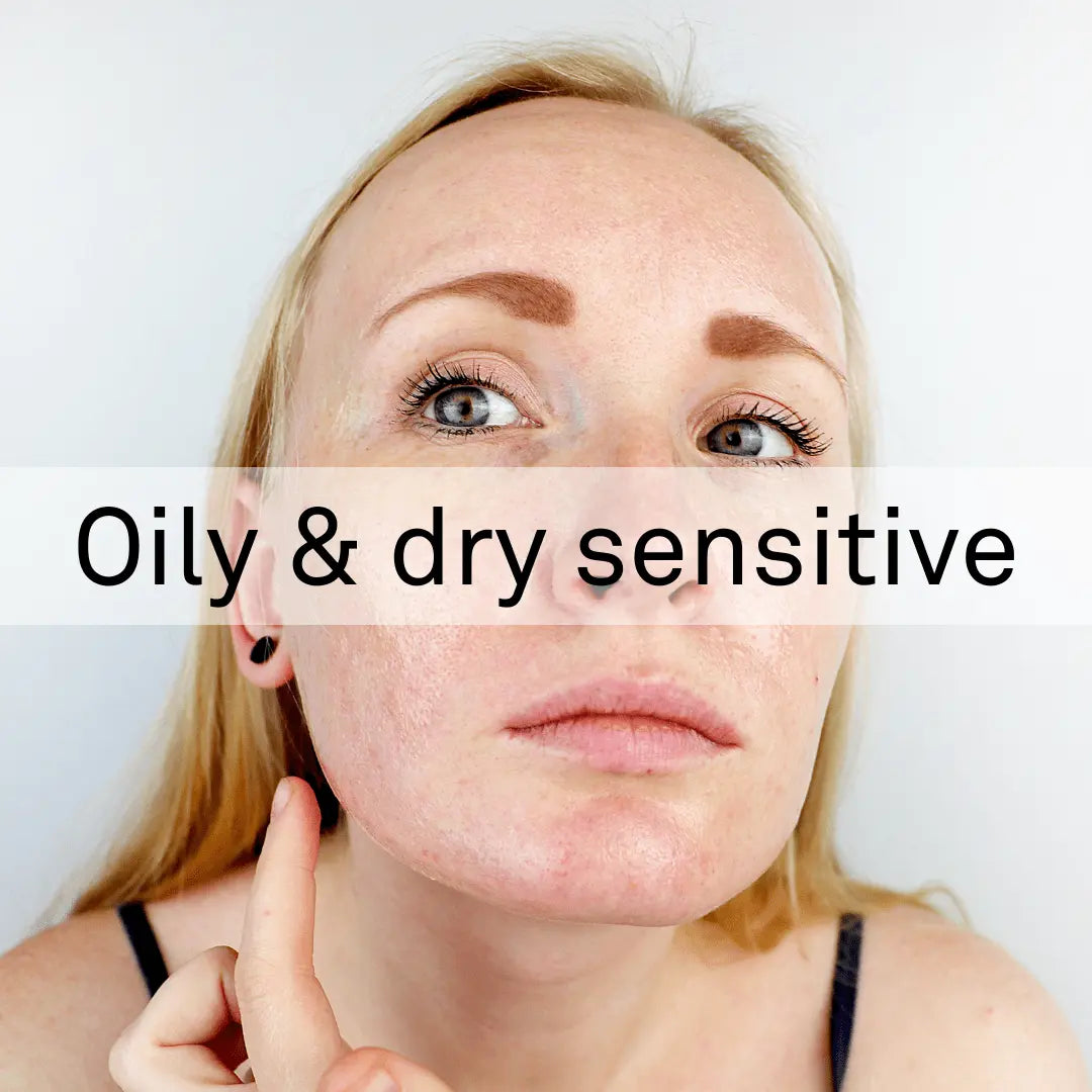 Combination Oily & Dry Skin with Surface Redness – Tagged 