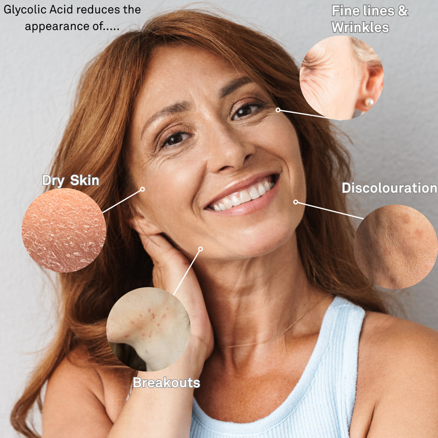 Glycolic Acid 10% Peel with Vitamin B5 30ml